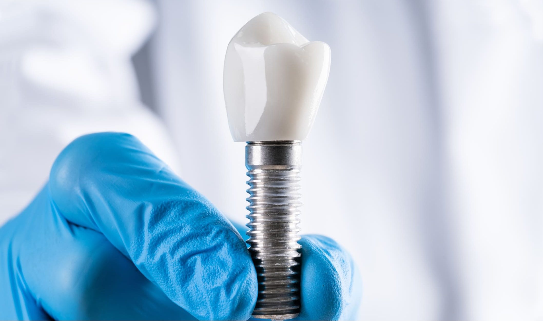 Implantes Dentales en Mataró | Expertos en Implantología