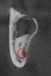 Tomografia computarizada 