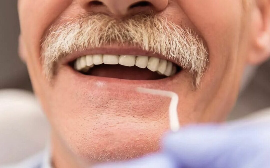 fumadores e implantes dentales