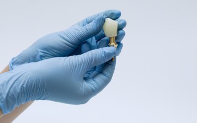 Cuánto cuesta un implante dental y por qué no existe un precio único